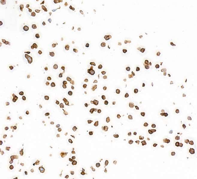 Pdgfr Alpha Antibody Blr128h Bsa Free Ab314105  Immunocytochemistry Img420679