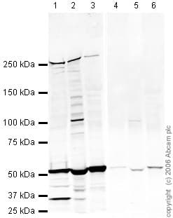 Fatty Acid Synthase Antibody Ab22759  Western Blot Img7492