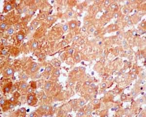 Cap1 Antibody Epr8339b Ab155079  Immunohistochemistry Formalin Pfa Fixed Paraffin Embedded Sections Img131939