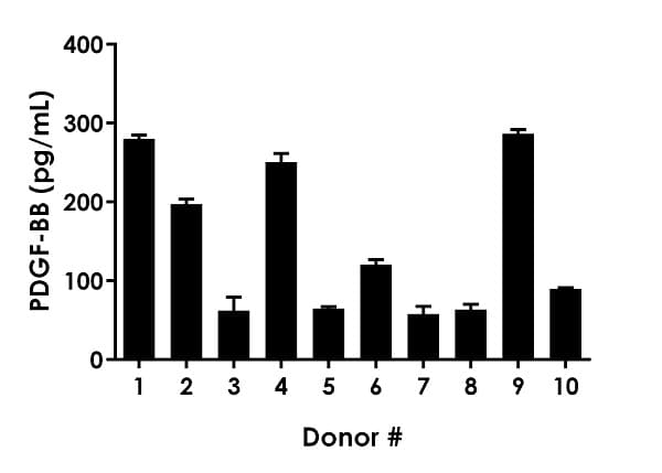 Human PDGF BB ELISA Kit(AB184860)