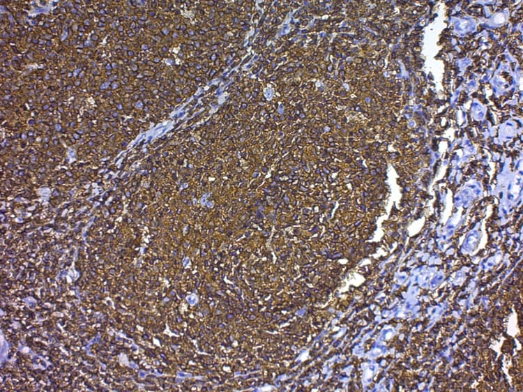 Antigen Retrieval Buffer (100X Citrate Buffer)(AB93678)