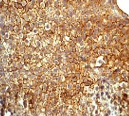 Pkc Delta Phospho Y311 Antibody Epr2609y Bsa And Azide Free Ab247449  Immunohistochemistry Formalin Pfa Fixed Paraffin Embedded Sections Img134239