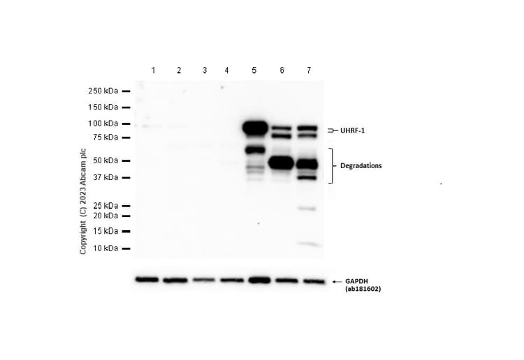 Uhrf1 Antibody Epr18803 11 Ab213223  Western Blot Img415952