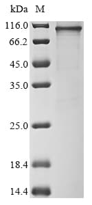Ab289752  Sds Page Img180020