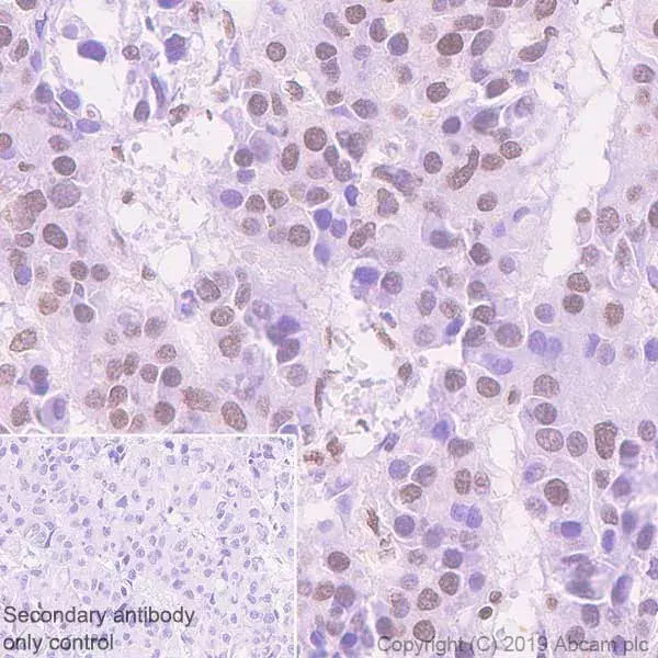 Anti-Histone H3 (acetyl K27) antibody [EP16602] - ChIP Grade(AB177178)