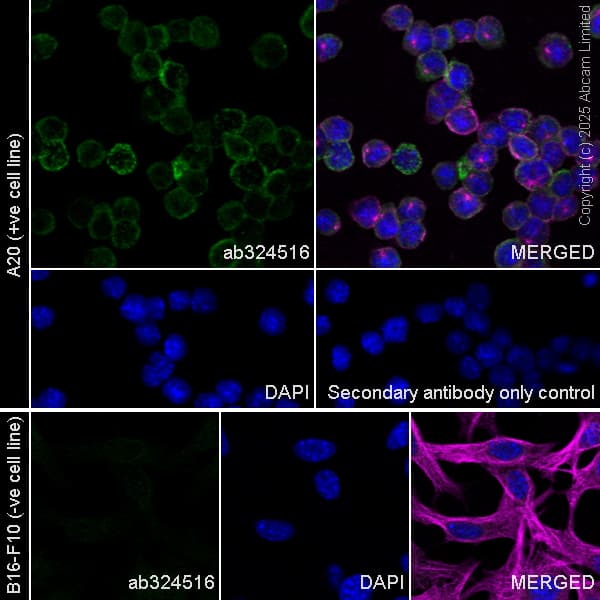 Alexa Fluor 594 Alpha Tubulin Antibody Ep1332y Microtubule Marker Ab202272  Immunocytochemistry Immunofluorescence Img450669