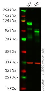Anti-CD146 antibody [EPR3208](ab75769)