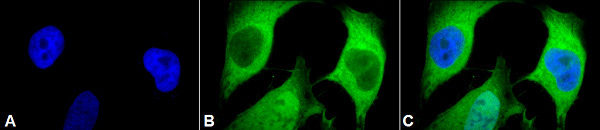 Anti-Ubiquitin antibody [5B9-B3](AB223378)