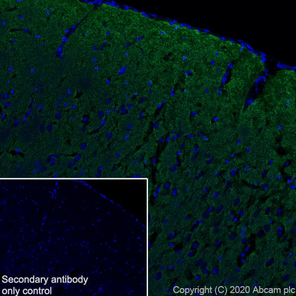 Anti-Synapsin I antibody [EPR23531-50] - Synaptic Marker(AB254349)