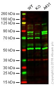 Calpain 1 Antibody Epr3319 Ab108400  Western Blot Img137310