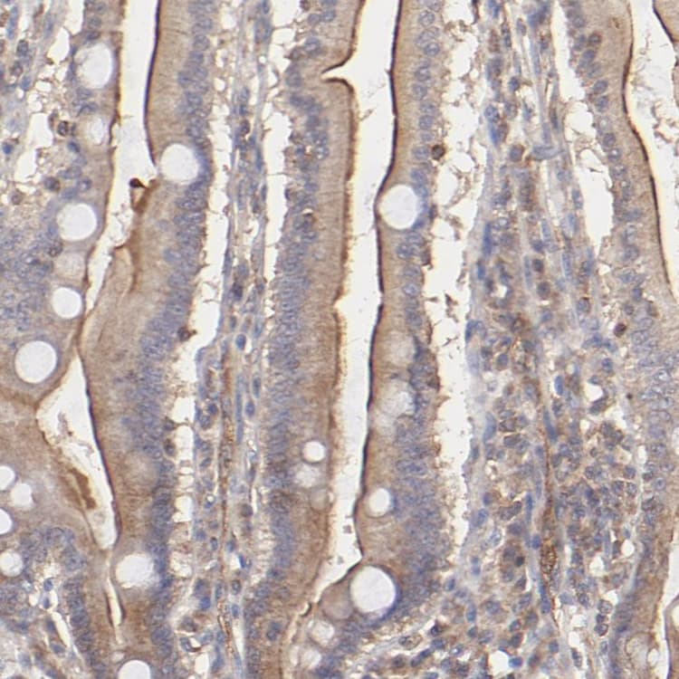 Ston2 Antibody Ab121165  Immunohistochemistry Formalin Pfa Fixed Paraffin Embedded Sections Img111583