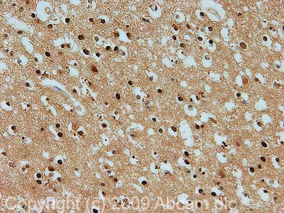 Prmt1 Antibody Ab73246  Immunohistochemistry Formalin Pfa Fixed Paraffin Embedded Sections Img108648