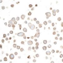 Anti-ZO1 tight junction protein antibody [BLR092G](AB276131)