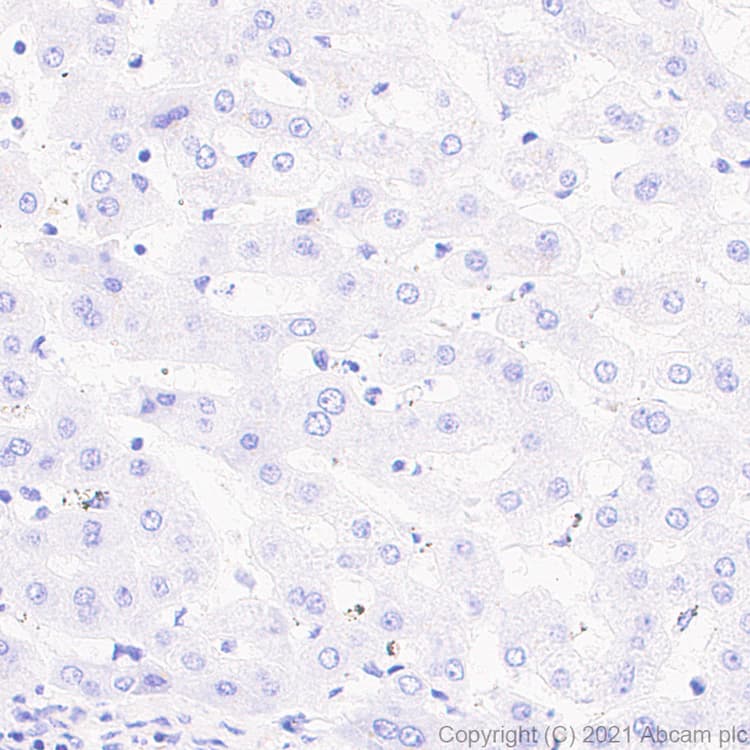 Cd127 Antibody Epr23747 333 Ab259806  Immunohistochemistry Formalin Pfa Fixed Paraffin Embedded Sections Img166420
