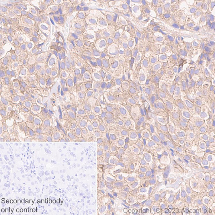 Anti-NUMB antibody [EPR21988] - BSA and Azide free(AB234108)