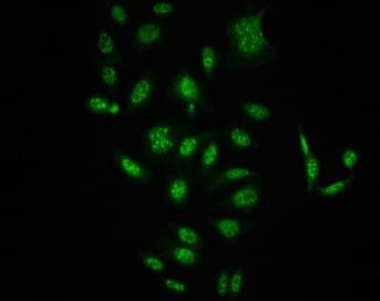 Raf1 Phospho S621 Antibody 1c2 Ab314035  Immunocytochemistry Immunofluorescence Img421380