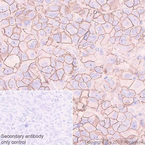 Anti-beta Catenin antibody [E247] - ChIP Grade(AB32572)