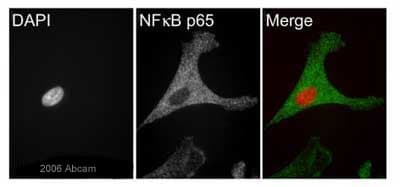 Anti-NF-kB p65 antibody(AB16502)