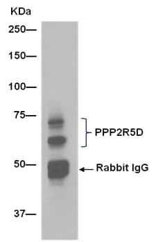 Anti-PPP2R5D antibody [EPR15617-50] - BSA and Azide free(AB250953)