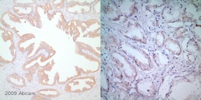 Braf Antibody Ep152y Ab33899  Immunohistochemistry Formalin Pfa Fixed Paraffin Embedded Sections Img139316
