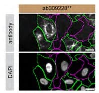 Anti-GBA antibody [EPR26755-29] - BSA and Azide free (Capture)(ab309228)