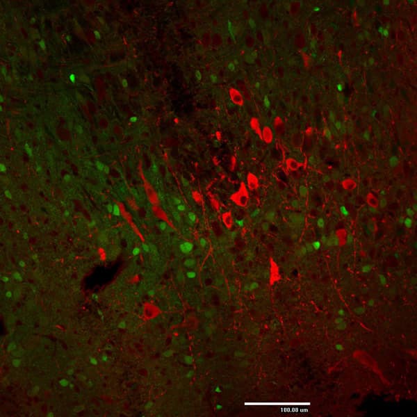Anti-Tyrosine Hydroxylase antibody(AB76442)