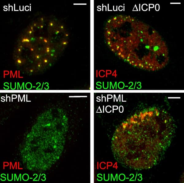 Anti-Sumo 2 + Sumo 3 antibody(AB3742)
