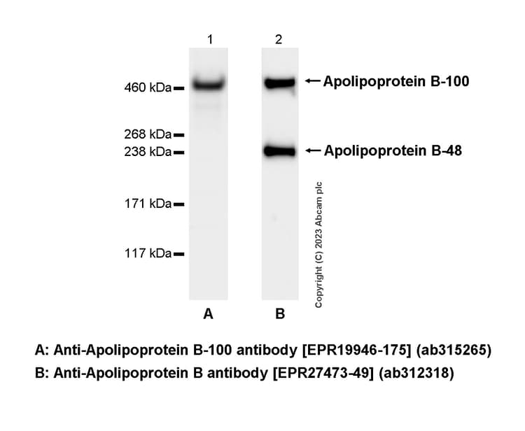Anti-Apolipoprotein B-100 antibody [EPR19946-175](AB315265)