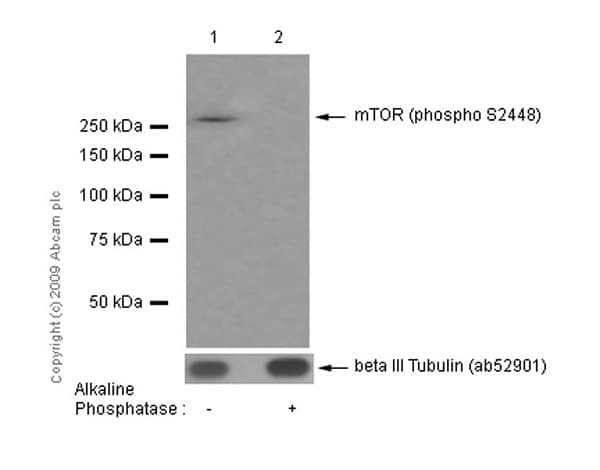 Anti-mTOR (phospho S2448) antibody [EPR426(2)](AB109268)