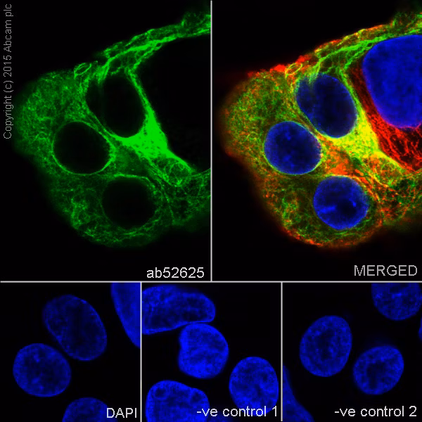 Cytokeratin 19 Antibody Ep1580y Cytoskeleton Marker Ab52625 Immunocytochemistry Immunofluorescence Img84735