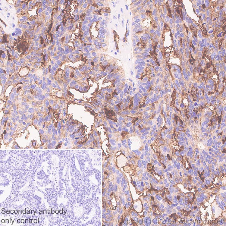 Alkaline Phosphatase Antibody Epr20428 147 Bsa And Azide Free Capture Ab252581  Immunohistochemistry Formalin Pfa Fixed Paraffin Embedded Sections Img440824