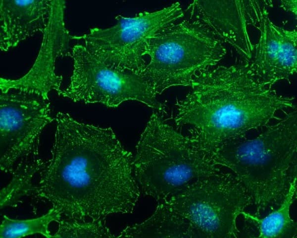 Anti-Sarcomeric Alpha Actinin antibody(AB137346)