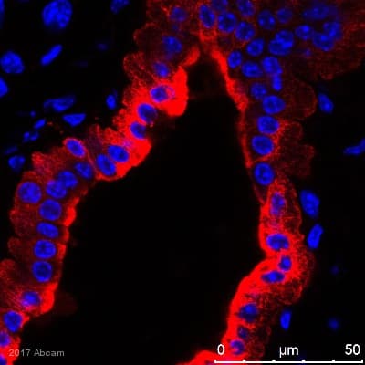 Anti-Cytokeratin 7 antibody [EPR17078] - Cytoskeleton Marker(AB181598)