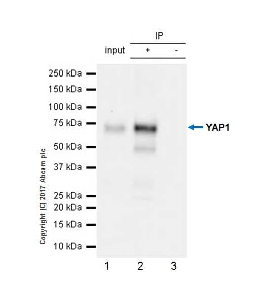 Anti-YAP1 antibody [EP1674Y](AB52771)