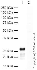 Anti-Cardiac Troponin I antibody(AB47003)