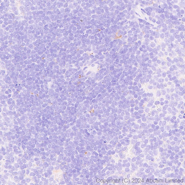 Anti-Cathepsin L/MEP antibody [EPR29413-573](AB321872)