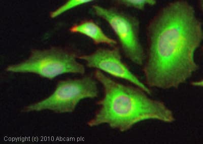 Anti-C5b-9 antibody(AB55811)