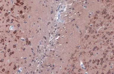 Anti-LC3B antibody - N-terminal(AB229327)