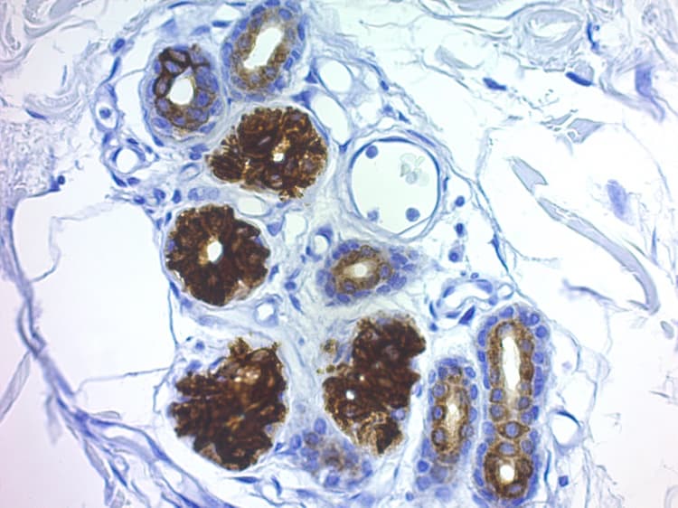 Proteinase K Antigen Retrieval Solution(ab64220)