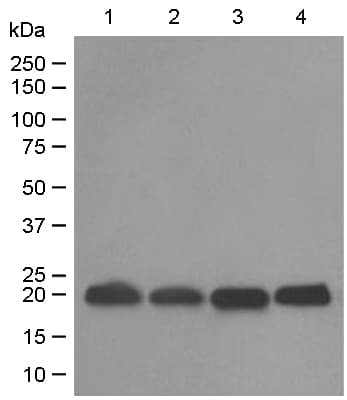 Anti-DUSP3 antibody [EPR5492](AB125077)