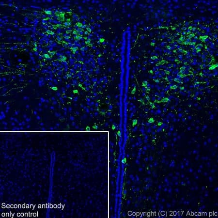 Anti-Vasopressin antibody [EPR20602](AB213708)