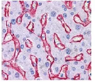 Anti-Collagen IV antibody(AB6586)