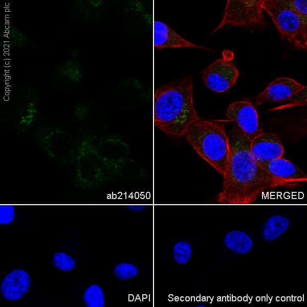 Anti-Osteopontin antibody [EPR21139-316](AB214050)