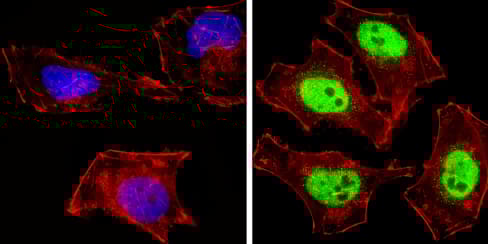 Anti-NCOR2/SMRT antibody(ab5802)