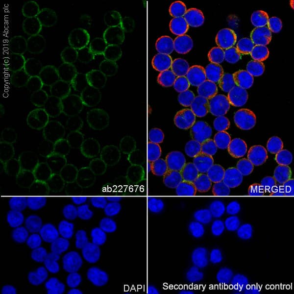 Anti-HLA-DPB1 antibody [SP229](AB227676)