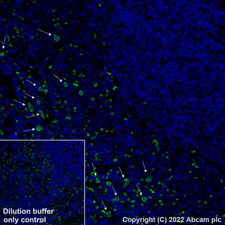 Alexa Fluor® 488 Anti-S100A9 antibody [EPR22332-75](AB307395)