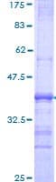 Recombinant Human Sortilin/NT3 protein(AB114233)