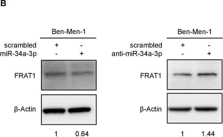 Anti-FRAT1 antibody [EPR3900](AB108405)