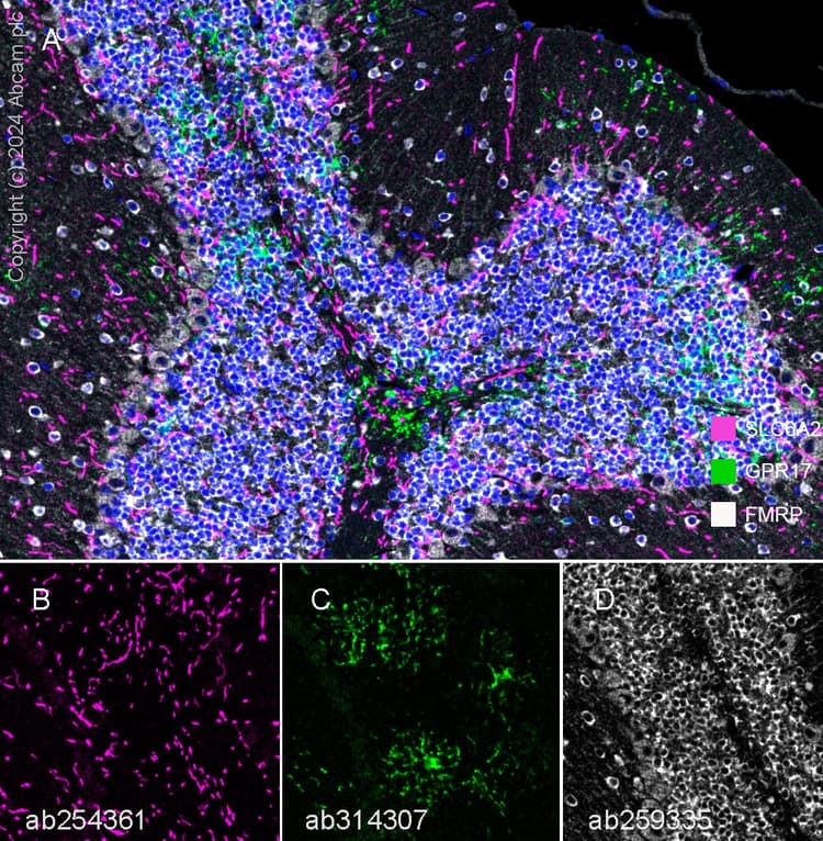 Anti-FMRP antibody [EPR23852-90] - BSA and Azide free(AB277489)