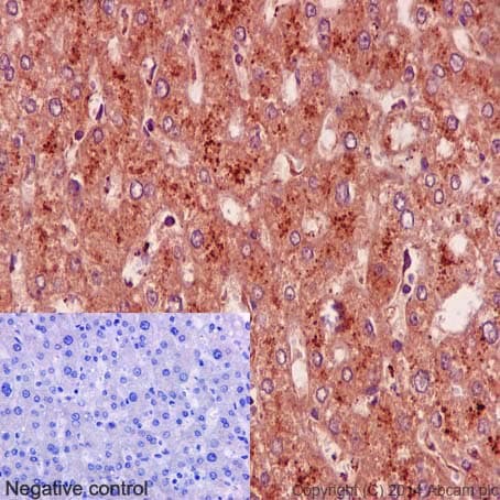 Anti-Niemann Pick C1 antibody [EPR5209] - BSA and Azide free(AB224268)